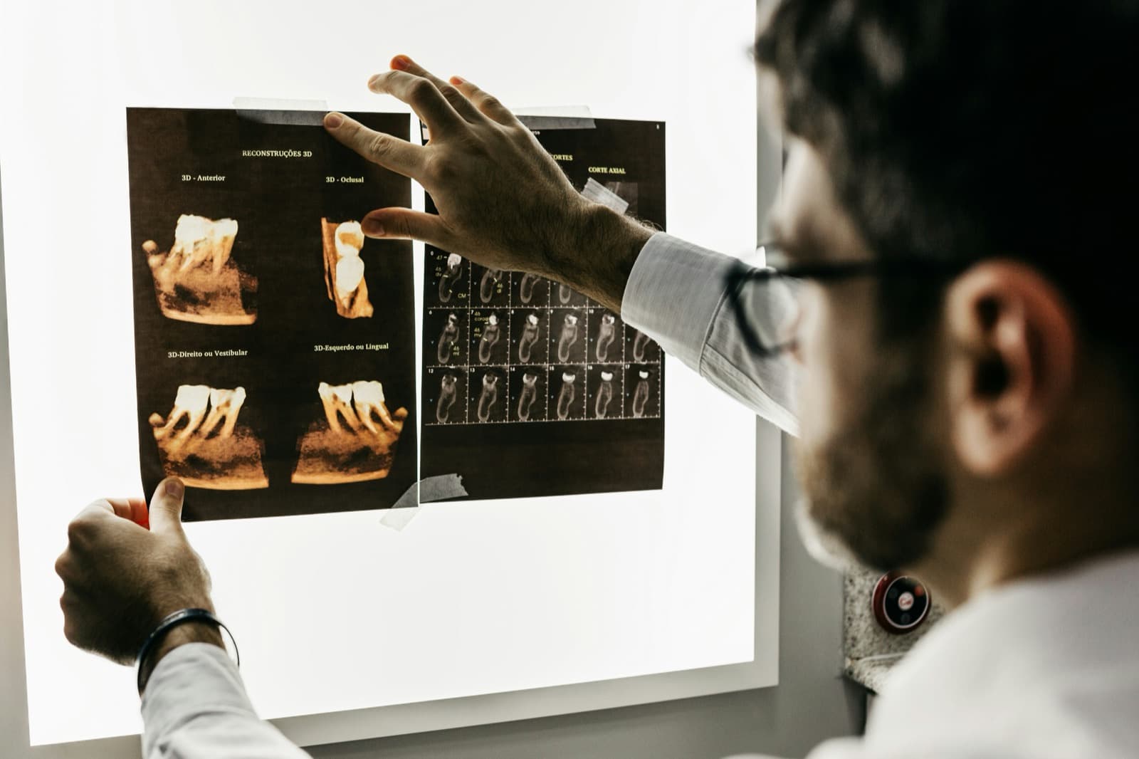 A young dentist in glasses studying 3D tooth scans pinned to a bright light box.